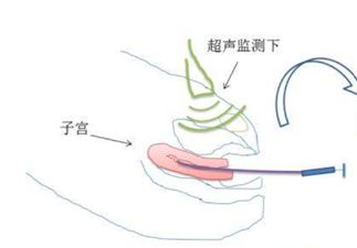 微信图片_20201109194001.jpg