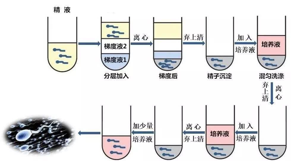 密度梯度离心法