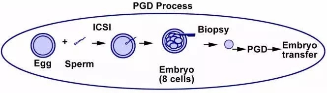 试管婴儿pgd技术