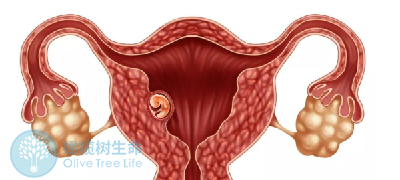 去泰国做试管婴儿，如何避免囊胚移植后生化？