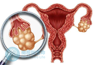 试管婴儿取卵后会损害卵巢健康吗？如何让卵巢更快恢复？ 