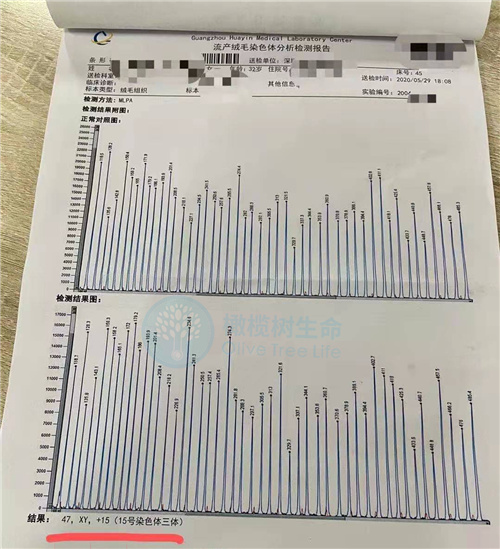 绒毛送检的检查报告