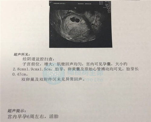 B超检查报告