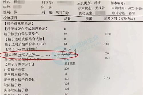 精液检查报告