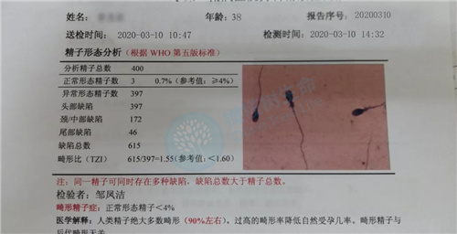 精液检查报告