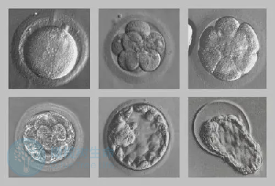 胚胎碎片率对试管成功率的影响