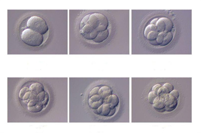 去泰国做试管是胚胎等级越高，胎儿越健康吗?