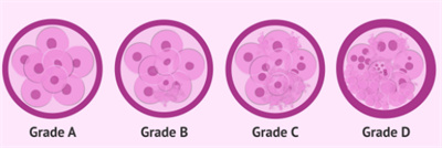 去泰国做试管是胚胎等级越高，胎儿越健康吗?