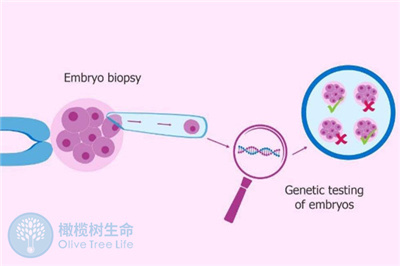 40岁以上做试管婴儿，发生胎停的概率有多大？