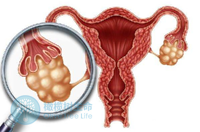 月经稀发做试管婴儿可以顺利完成取卵吗？