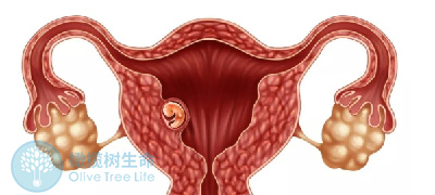 高雌激素会影响子宫内膜容受性吗？