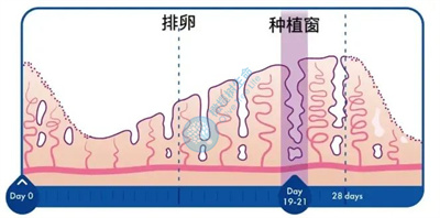 该放手一搏还是不可错失一个，关于试管养囊该如何抉择?