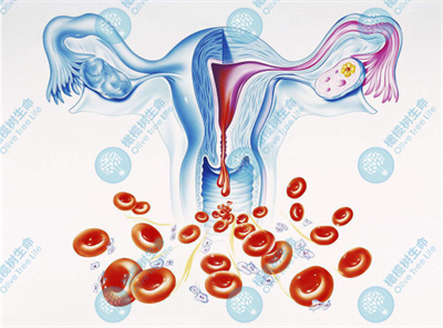 子宫内膜炎做试管婴儿，橄榄树生命应对策略助您好孕