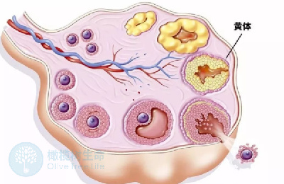 黄体功能不全对泰国试管移植有哪些影响?