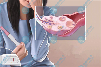 卵泡发育不良不孕率达27% 试管婴儿圆宝宝梦