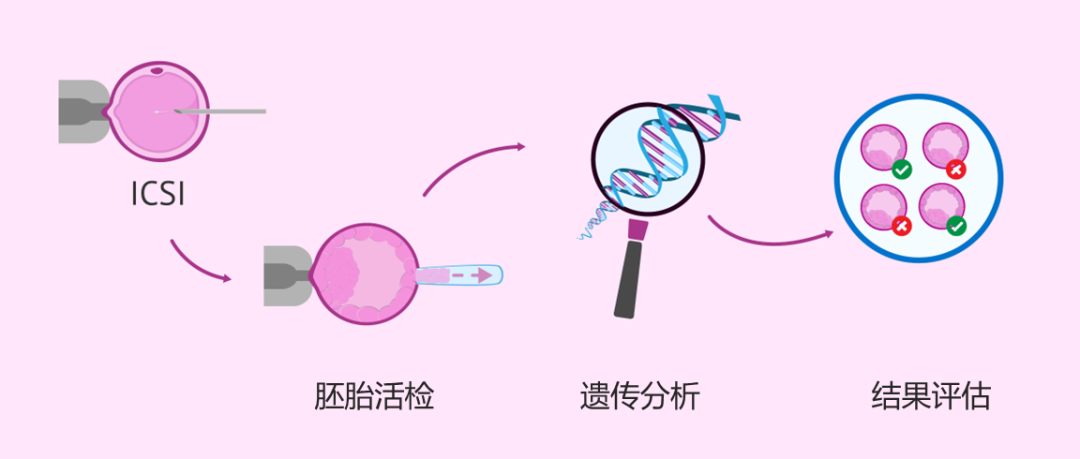 生化胎停是优胜劣汰吗？做试管婴儿一定要回避这几个误区