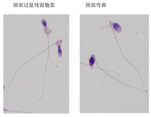 别瞎造了！精子存活率低也会影响试管成功率