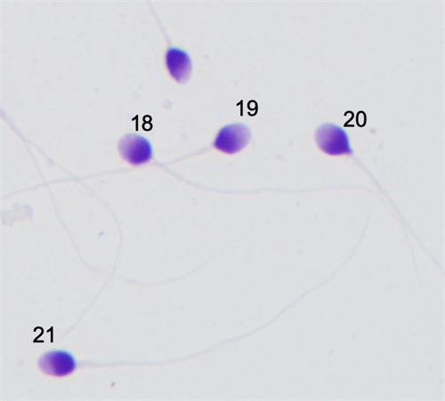 别瞎造了！精子存活率低也会影响试管成功率