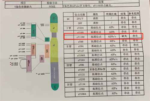 不是空穴来风！生育前必须要了解这项检查