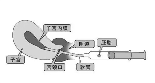 保证试管婴儿成功率最大化的九个因素！