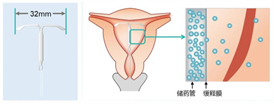 胚胎喜欢的内膜有3个特点！7招就能养出来！