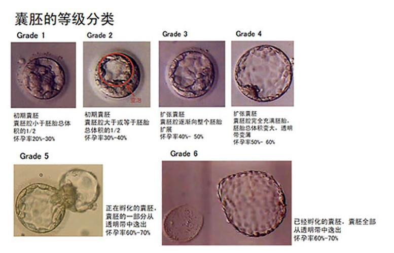 多次移植失败，要从这4个方面综合改善！