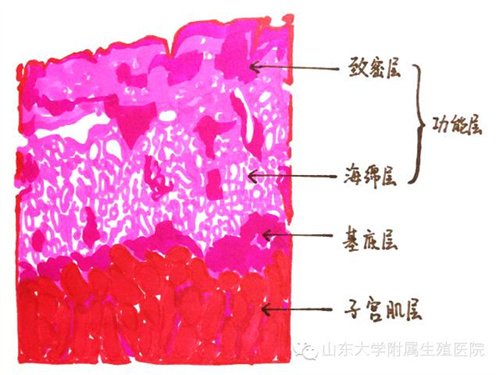 子宫内膜回声欠均匀，通常与这4个因素有关！