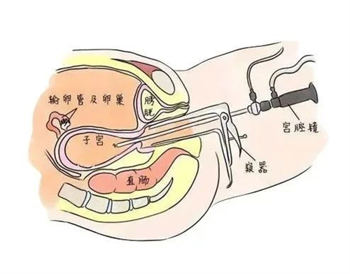 子宫内膜回声欠均匀，通常与这4个因素有关！