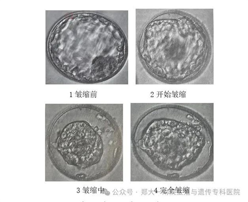 龙年接龙宝|带你揭秘囊胚的冷冻与复苏！