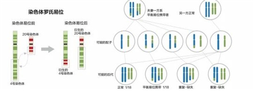 盘点三代试管的利与弊，一定有你不知道的真相！