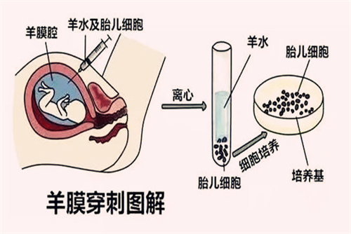 盘点三代试管的利与弊，一定有你不知道的真相！