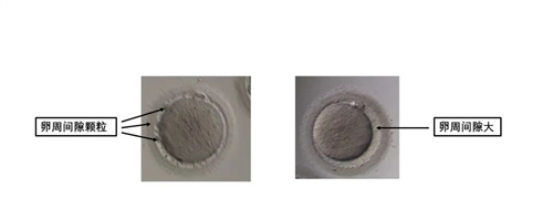 卵母细胞形态学异常对试管婴儿有什么影响？