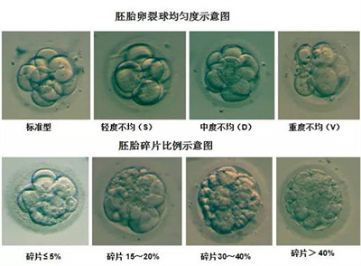 试管周期中胚胎碎片率的影响因素及其控制策略