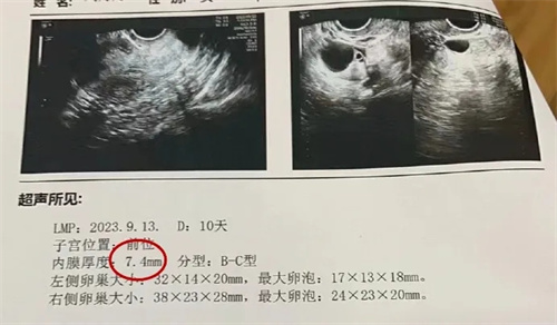 内膜薄？反复移植失败？试试这个“黑科技”！