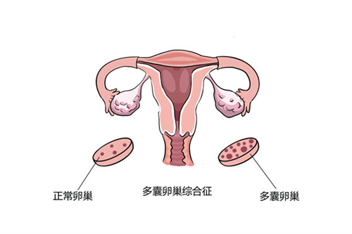 这三类人群需要在准备移植前打“降调针”！