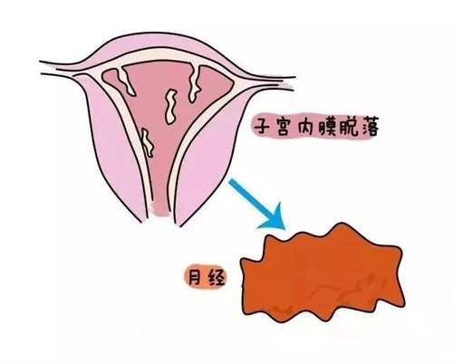 补了孕激素，为什么内膜还是长不好？