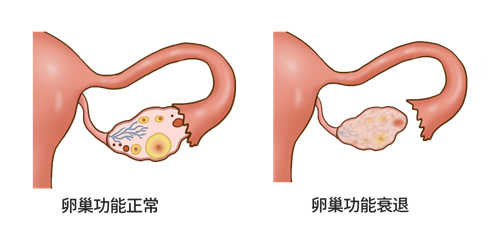 高龄女性的生育阻力究竟有哪些？选择三代试管的原因是什么