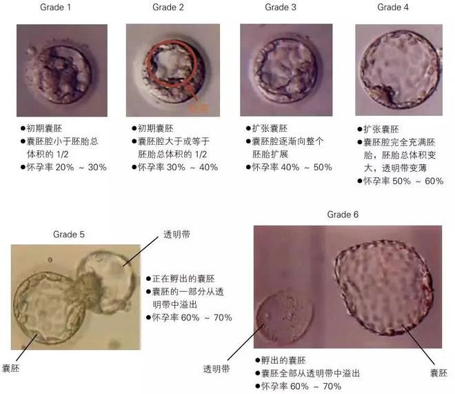 胚胎质量好不好，看这三个指标就知道！