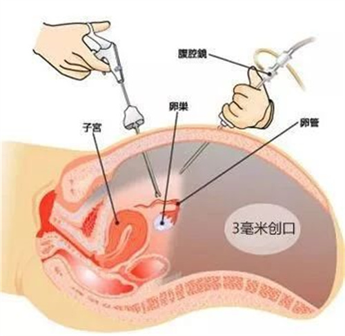 有优质胚胎也难怀上，这个因素最常见！