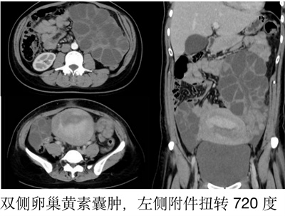 卵泡大又圆还是怀不上，有可能是因为它！