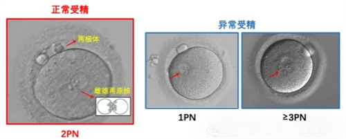 做试管婴儿为什么解冻后的胚胎还会掉等级？