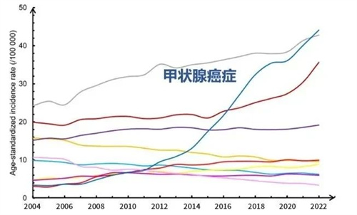 这个影响生育的小器官，你还不重视吗？