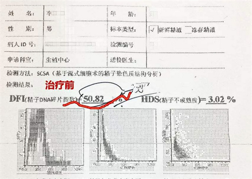 精子质量差会不会影响胎儿发育？