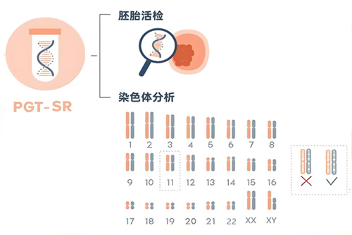 《Nature》揭秘：携致病基因或无症状，试管婴儿技术预防遗传病代际传播！