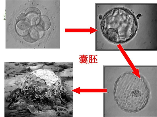 做试管婴儿就能避免宫外孕吗？如何减少宫外孕的发生？