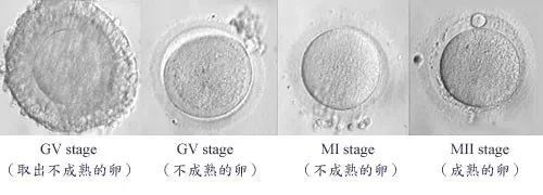 这项试管新技术真的能解决大龄卵少的难题？