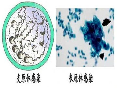 最易引发胎停的8个高危因素，你一定要知道！