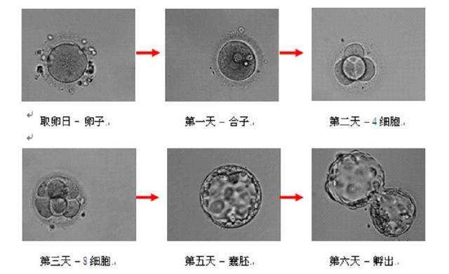 泰国试管婴儿囊胚移植成功率高达85