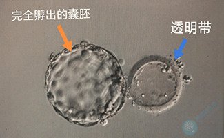 颜值不代表实力！这项新技术可预测胚胎着床成功率