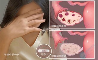 AMH下降不可逆！这4类伤卵习惯，试管备孕女性别忽视